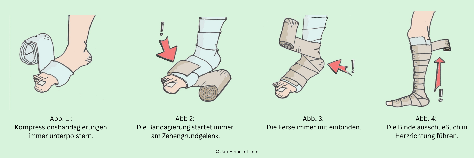 Kompressionstherapie. Richtig gewickelt