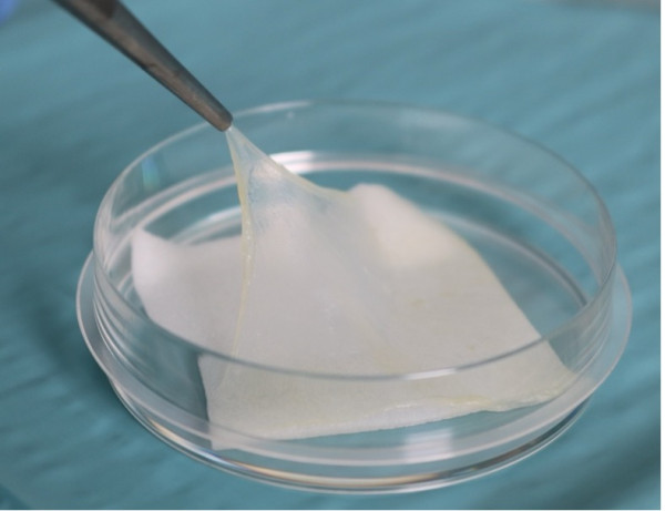 © Dr. Nicola Hofmann, Dr. Judith Friedrich | Amnionmembran © Dr. Nicola Hofmann, Dr. Judith Friedrich | Amnionmembran
